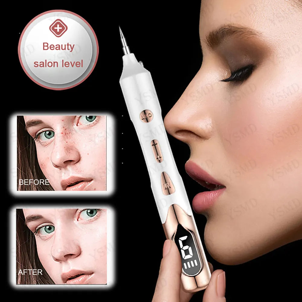 Laser Plasma Pen for Skin Tag Remover