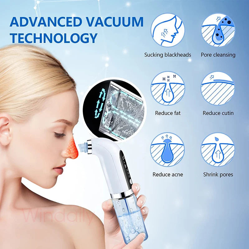 Electric Micro Blackhead Remover/Pore Vacuum Cleaner