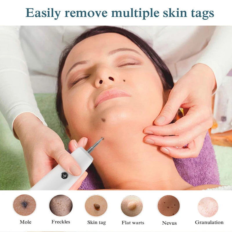 Skin Tag Remover 15-Level Laser Plasma Pen