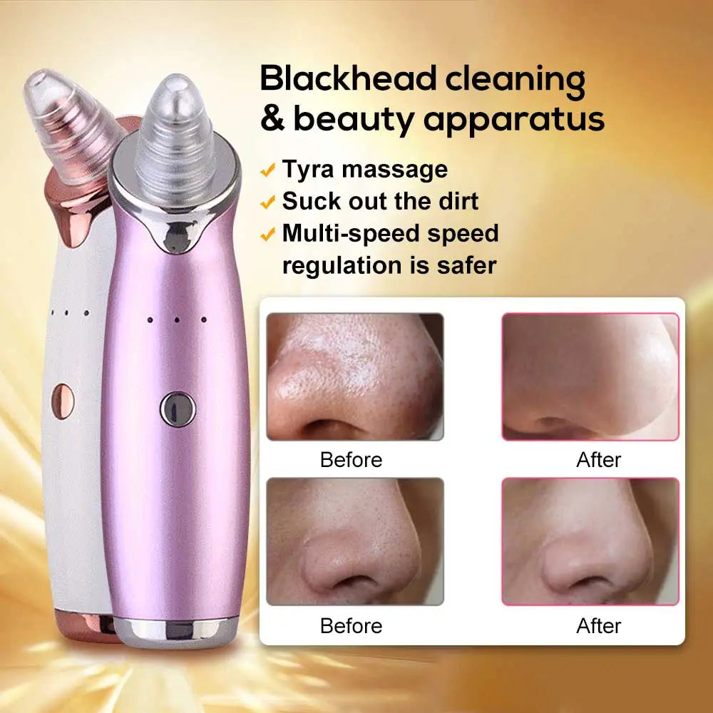 4-in-1 LED Face Lift Massager for Skin Rejuvenation