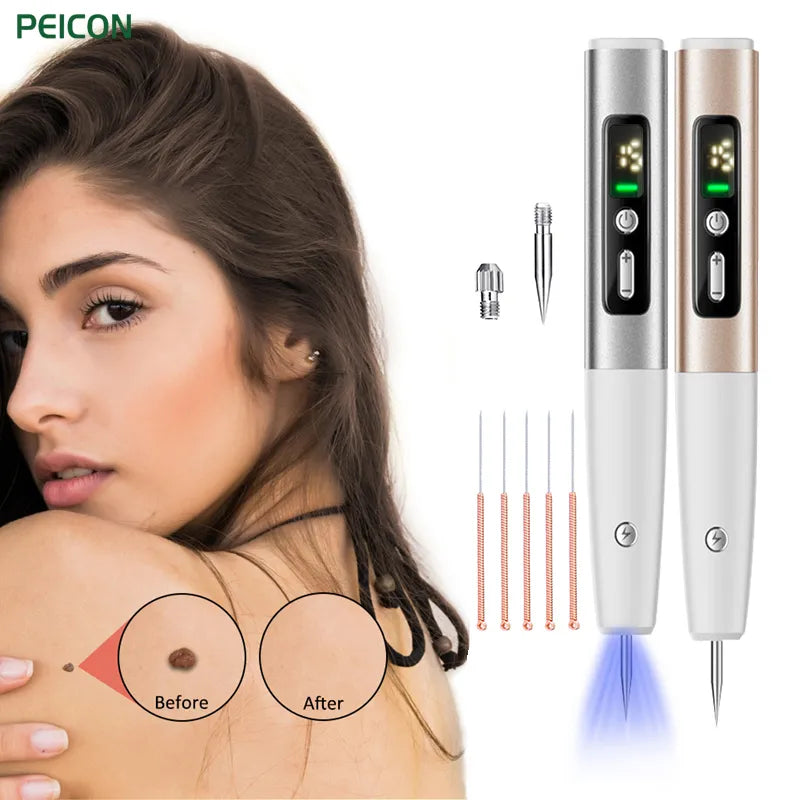 Skin Tag Remover 15-Level Laser Plasma Pen