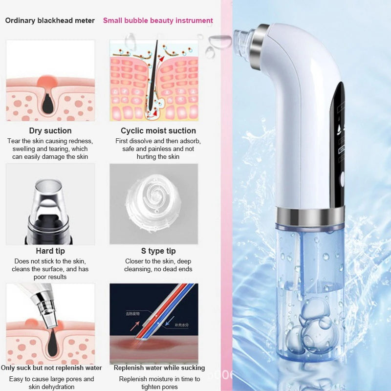 Electric Blackhead Remover/Pore Vacuum Cleaner