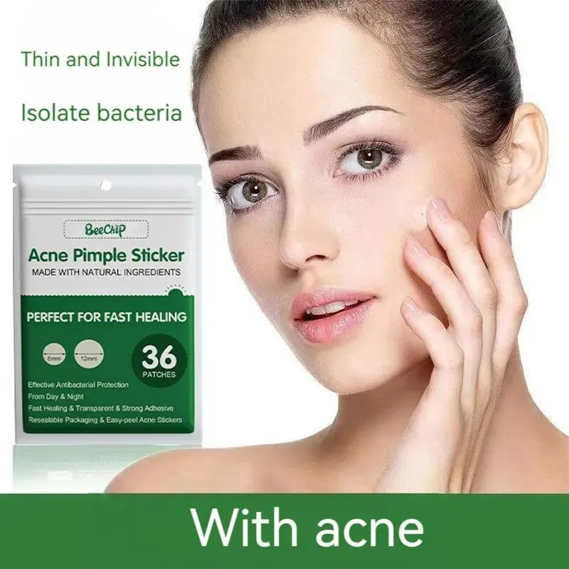 24/36pcs Hydrocolloid Acne Patch Blemish Stickers For Face And Skin Breathable Waterproof Gentle Non-Irritating Acne Stickers
