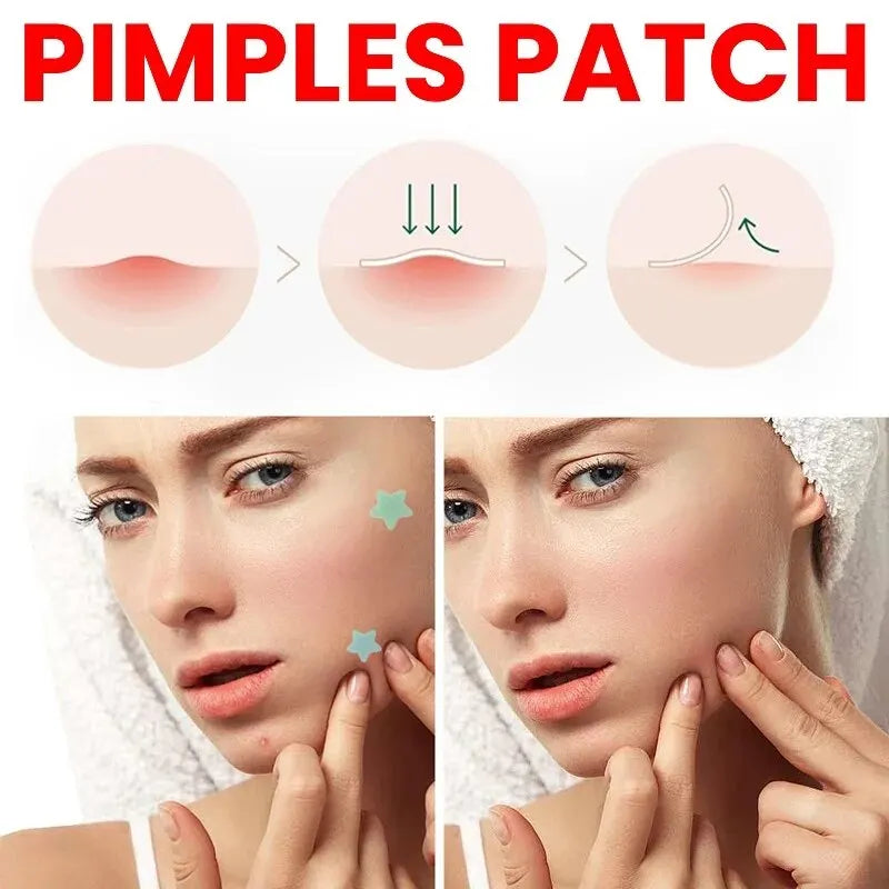 Repair Acne Patch Facial Skin Care Fade Blemishes Pimple Marks Closed Acne Blemishes Cover Acne Pimple Repair Patch