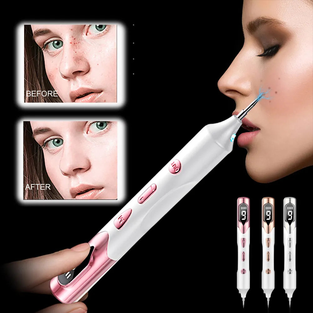 Laser Plasma Pen for Skin Tag Remover