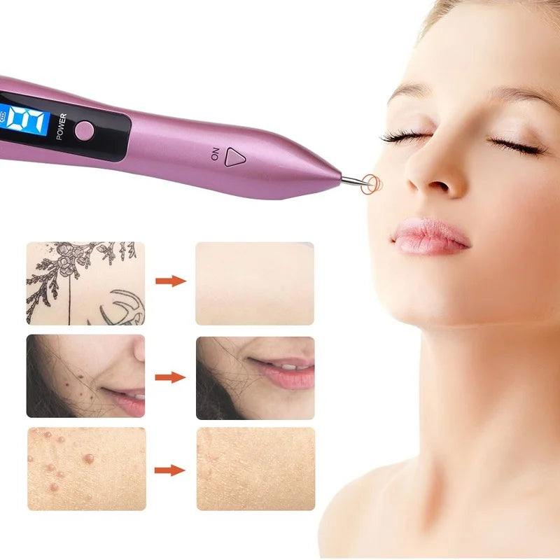 Laser Plasma Pen Machine for Freckle Remover