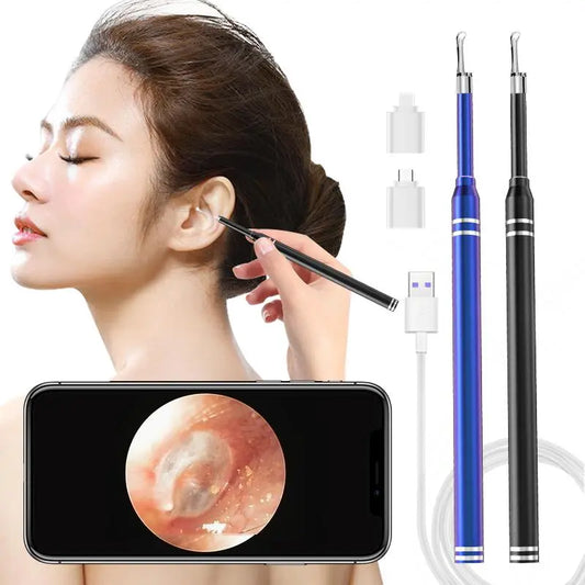 Smart Ear Cleaner Endoscope 5.5mm 3-in-1 Ear Otoscope Earwax Remover Picker with 2 Ear Scoops Support Android PC Type-C