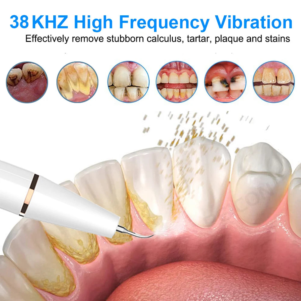 Ultrasonic Dental Scaler for Teeth Tartar Stain